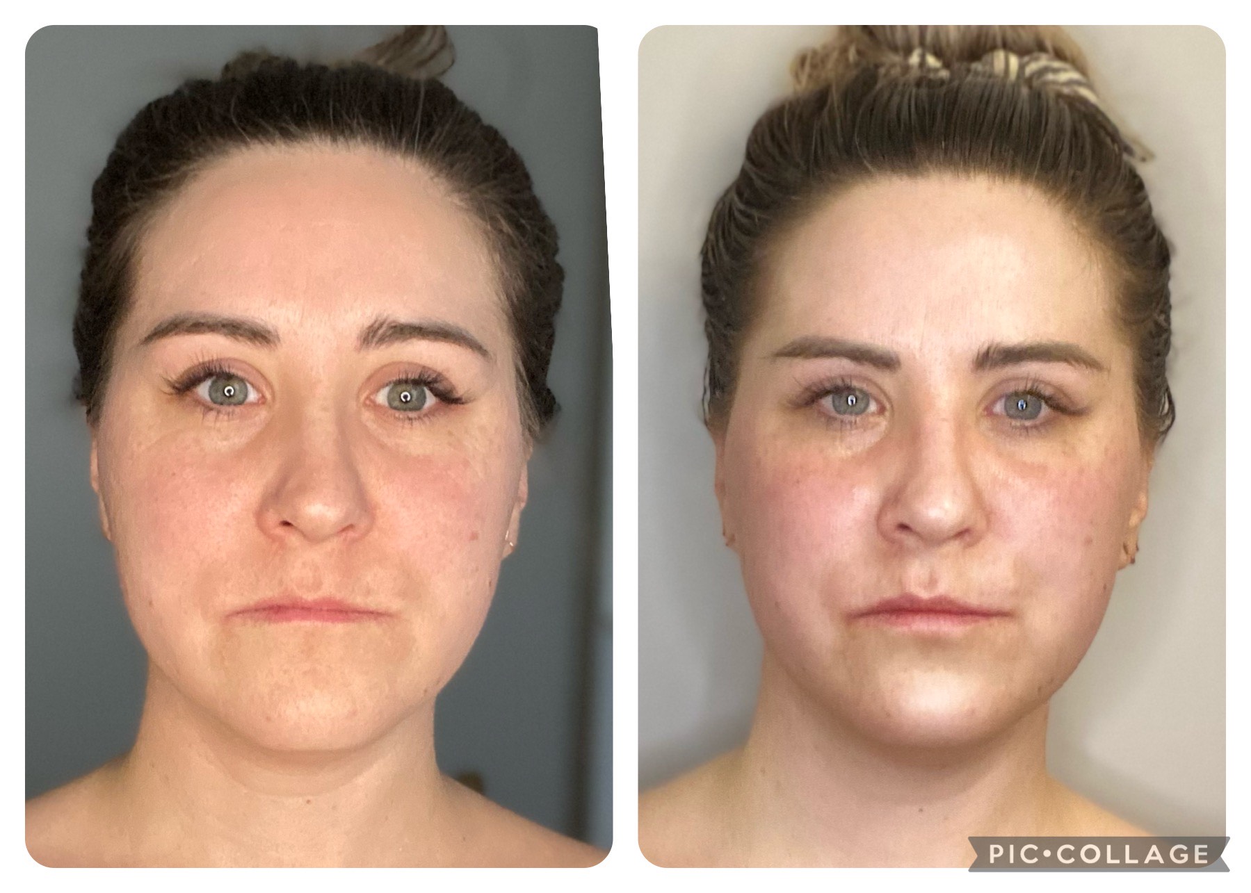 Facial Rejuvation Massage